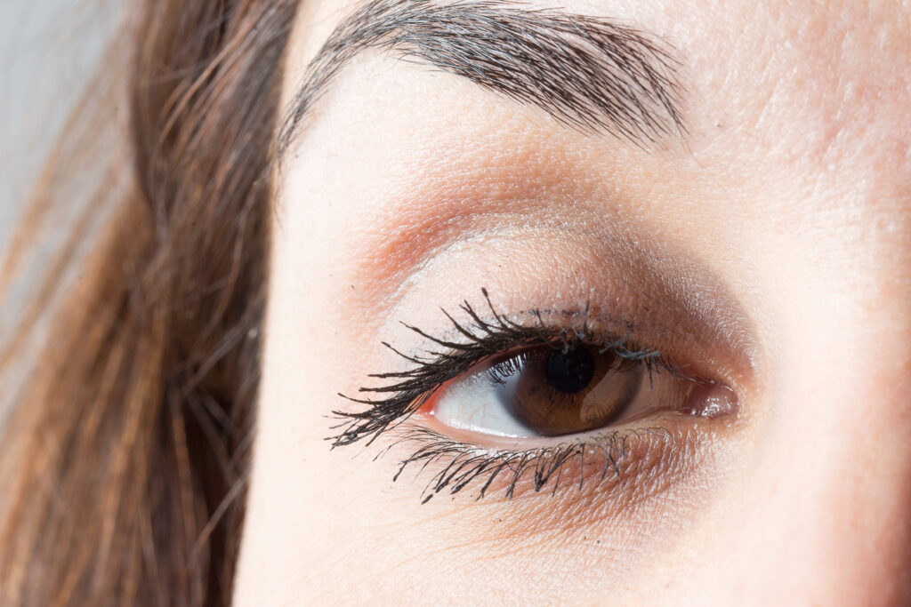 瞼のタルミ・眼瞼下垂イメージ