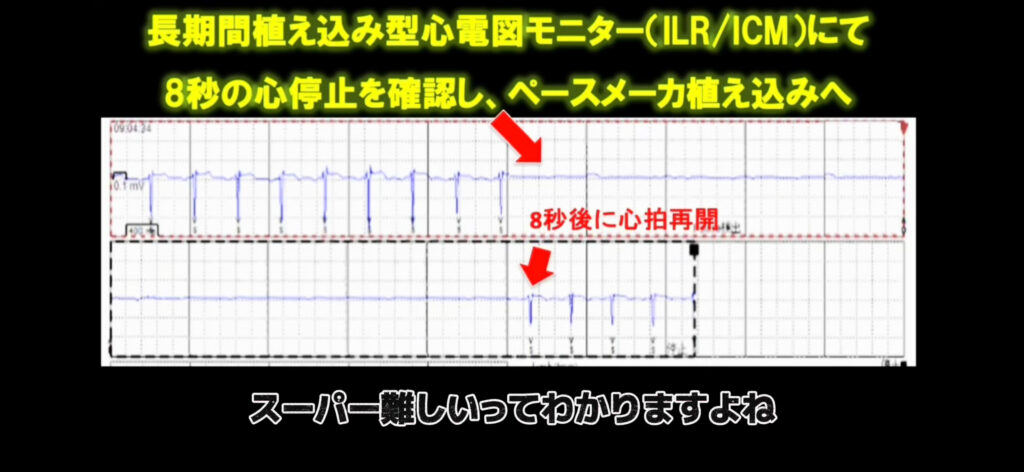 ④失神中に心臓が止まっている時間