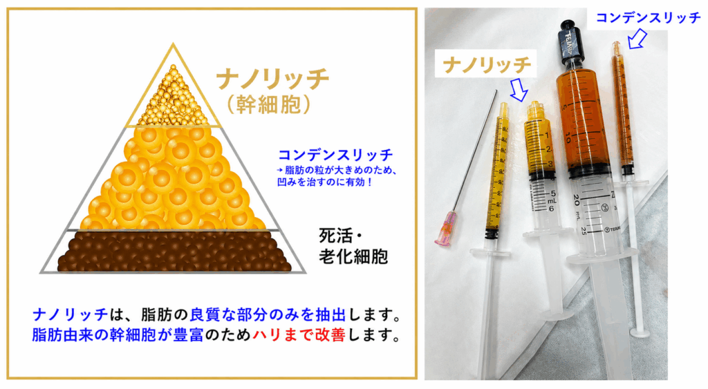 4．当院の治療法②：ナノリッチ