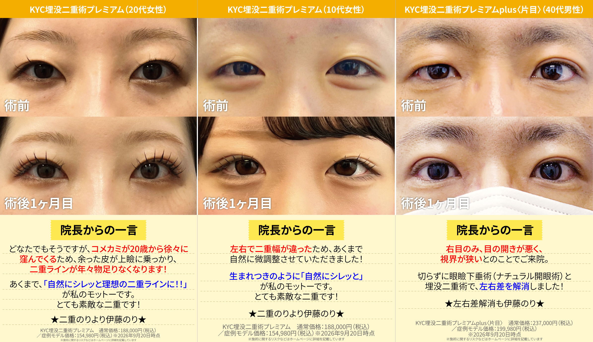 1. 埋没二重術や切らずに眼瞼下垂術「ナチュラル開眼術」はこんな方にオススメ