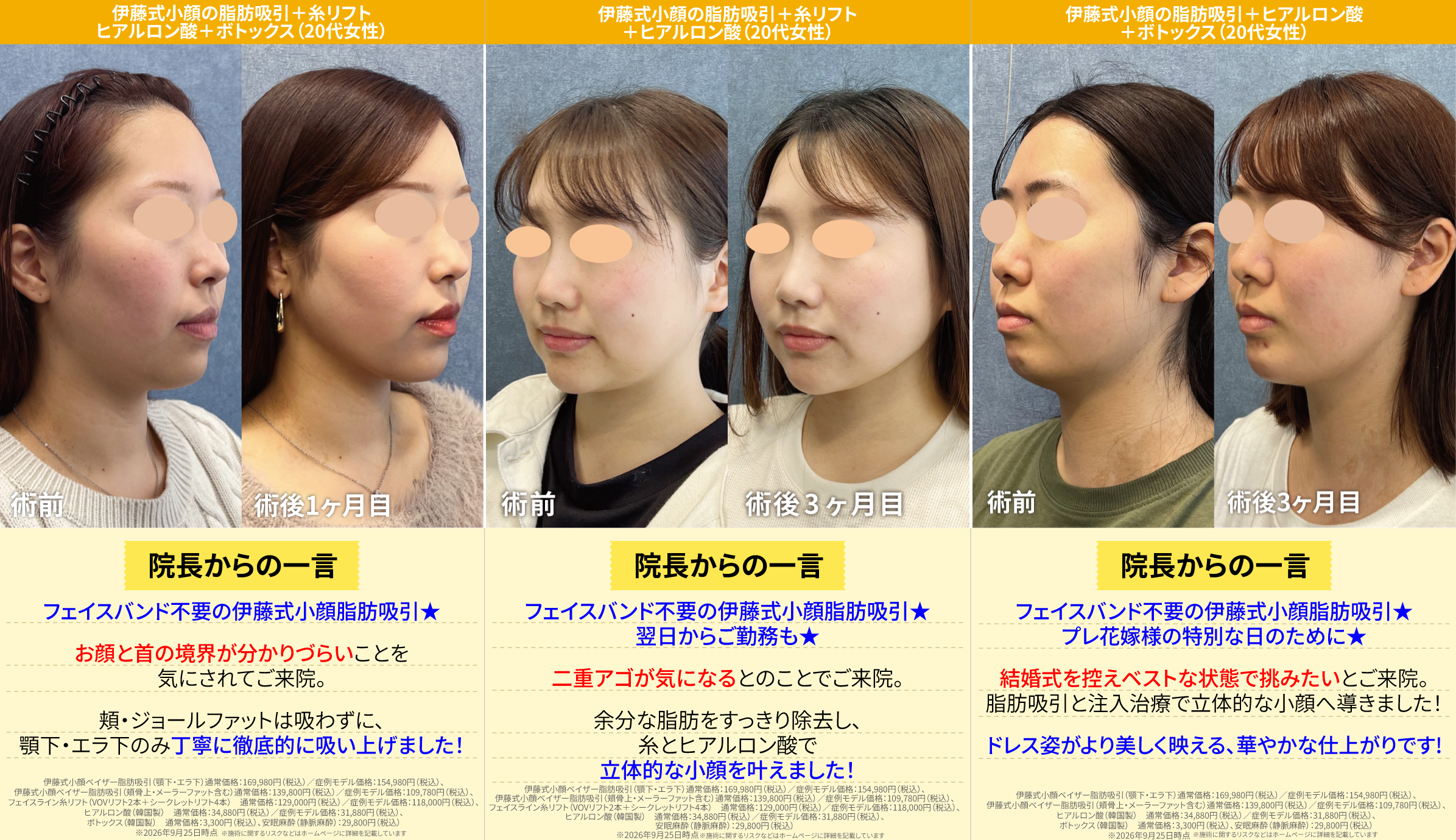 1. 脂肪吸引はこんな方にオススメ