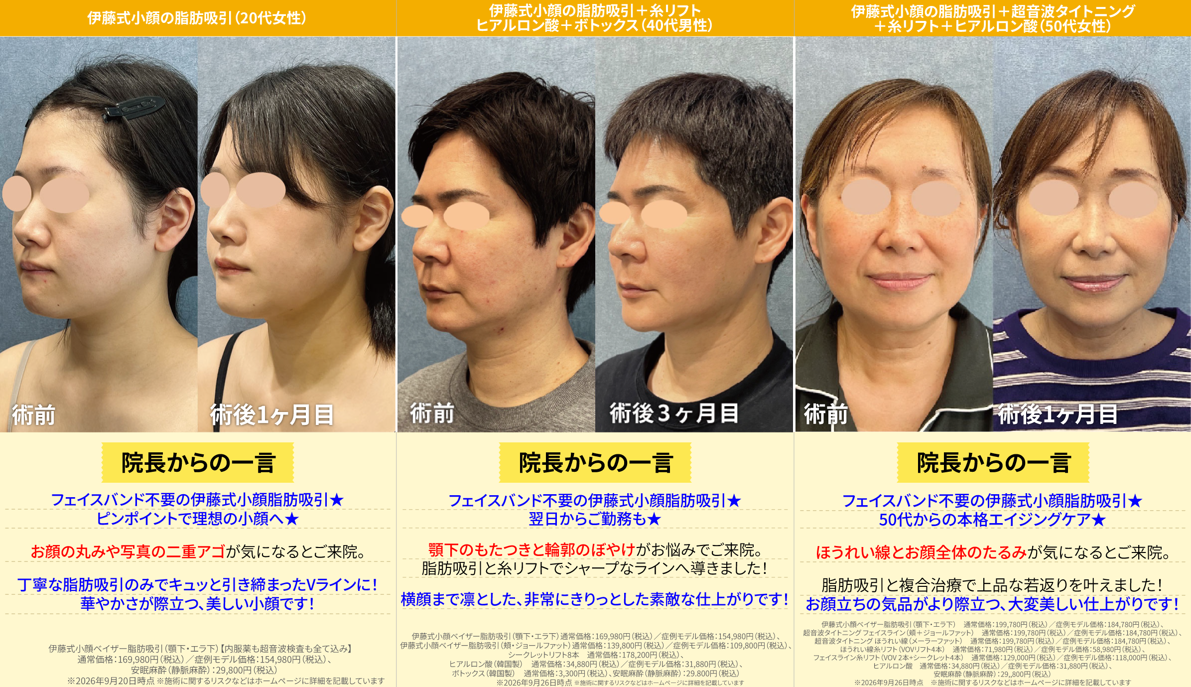 1. 脂肪吸引はこんな方にオススメ
